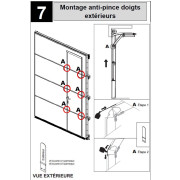 Kit Anti Pince Doigt Extérieur